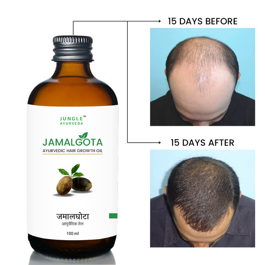 Jamalgota oil for hair growth and control hair fall | 100% Natural for Long, Thick & Strong Hair | 100 ml
