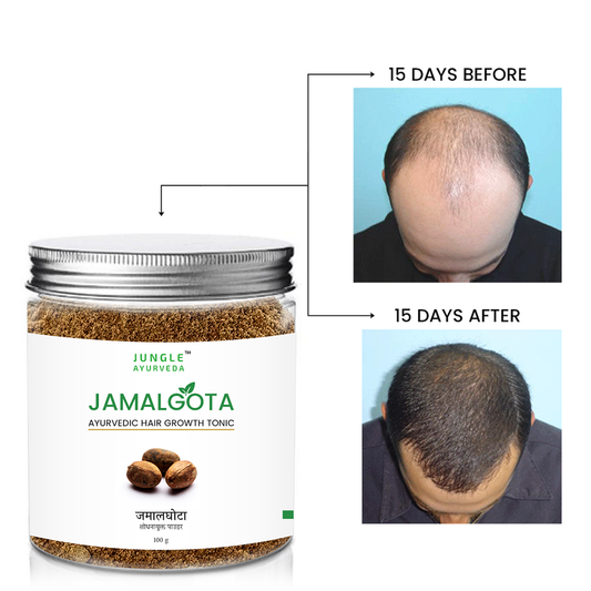 Jamalgota Powder for Hair Growth | Natural Ayurvedic Powder for Hair Fall Control & Scalp Nourishment | Herbal Hair Care for Men & Women