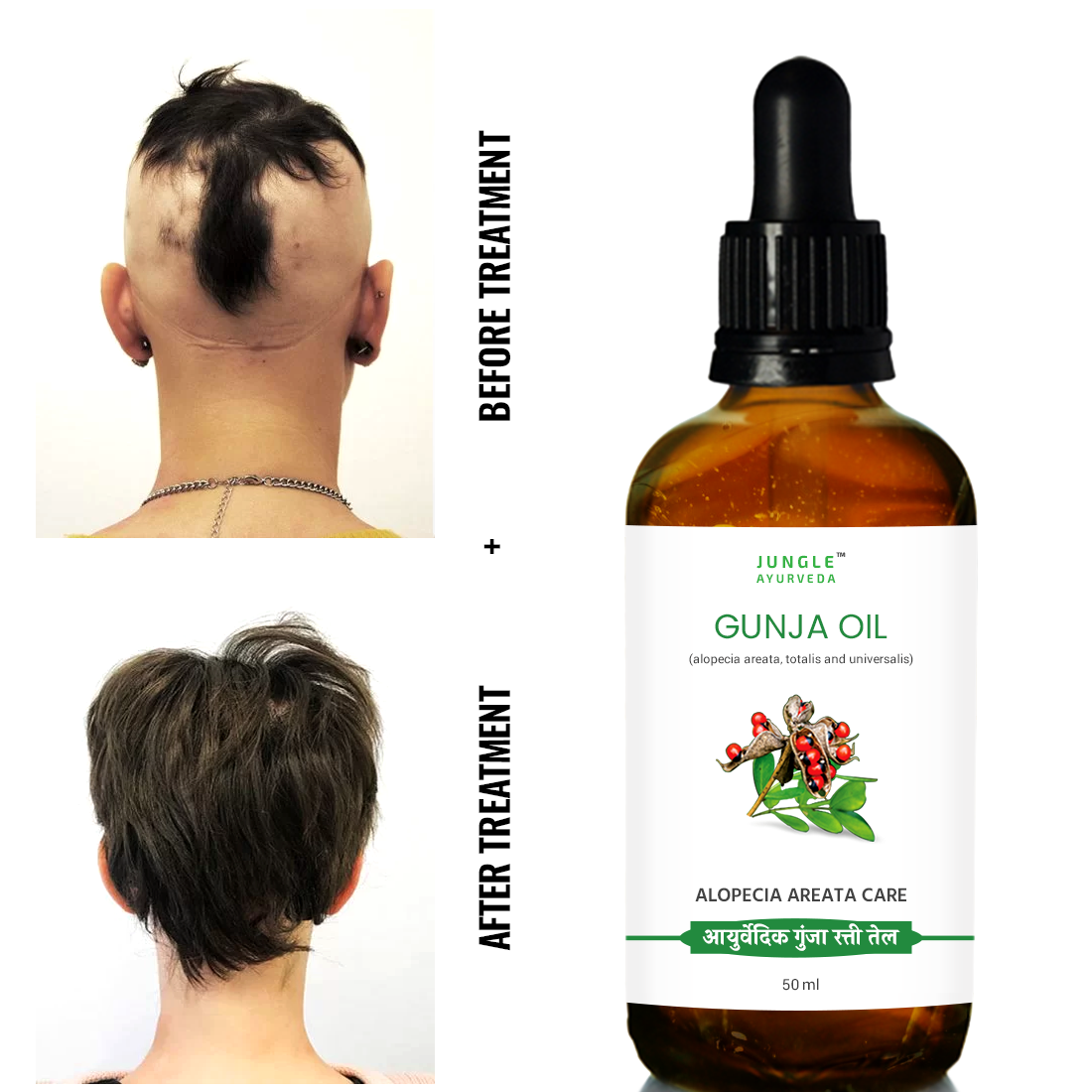 Gunja Oil for Hair Growth & Alopecia care | For Hair Fall Control, Scalp Treatment & Strong Healthy Hair | For Men & Women 50 ml