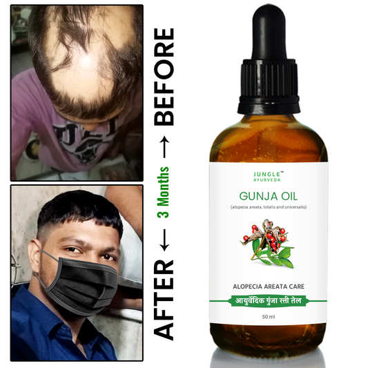 Gunja Oil for Hair Growth & Alopecia care | For Hair Fall Control, Scalp Treatment & Strong Healthy Hair | For Men & Women 50 ml