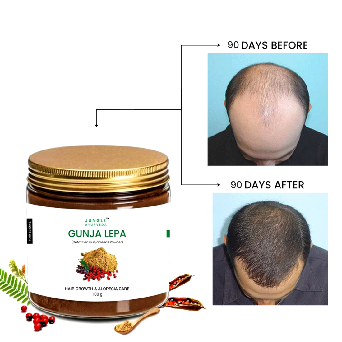 Gunja Powder for Hair Growth & Alopecia  | Ayurvedic Hair Fall Control Powder, Scalp Treatment for Strong & Healthy Hair | For Men & Women