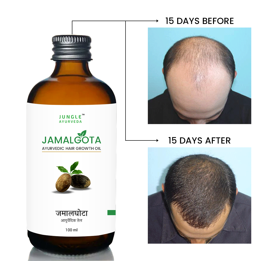 Jamalgota oil for hair growth and control hair fall | 100% Natural for Long, Thick & Strong Hair | 100 ml